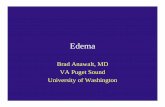 Edema - Physician Educationphysicianeducation.org/downloads/PDF Downloads for... ·  · 2016-10-154 Edema due to hypoalbuminemia: common causes • Impaired protein synthesis –