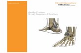 Ankle Fusion Small Fragment System - Corporate · PDF fileAnkle Fusion Small Fragment System. 2 Product overview Indications The Smith & Nephew PERI-LOC Ankle Fusion Plating System