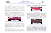 Meat Color - Purdue University color.pdf · product is its color and thus color is of utmost ... products will affect how the meat color changes ... oxidation of the pigment to form