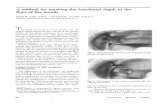 A method for marking the functional depth of the floor of ... · PDF fileA method for marking the functional depth of the ... removable partial denture. ... The back of the marking