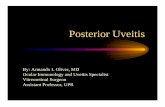 Uveitis Posterior - School of Medicine – Medical Science ... Retinochoroidopathy • Bilateral Retinochoroidopathy: – A chronic posterior uveitis characterized by vitritis and