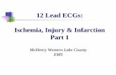 12 Lead ECGs: Ischemia, Injury & Infarction Part 1centegra.org/wp-content/uploads/2013/06/12-Lead-Ischemia-Injury... · Ischemia, Injury & Infarction. Part 1. ... aVL Lateral. V1