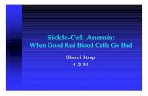 Sickle-Cell Anemia sickle cell hemoglobin (HbS), the aliphatic side In sickle cell hemoglobin (HbS), the aliphatic side chain of the valine residue creates a protrusion where none