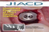 The Journal of Implant & Advanced Clinical Dentistry ... Journal of Implant & Advanced Clinical Dentistry Volume 6, No. 2 February 2014 Immediate Placement of Short Dental Implants