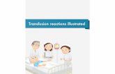 Transfusion reactions illustrated - yuketsu.jstmct.or.jpyuketsu.jstmct.or.jp/.../151105_Transfusion_reactions_illustrated.pdf · Transfusion reactions illustrated. Chapter 1 ... blood
