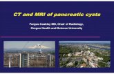 CT and MRI of pancreatic cysts - Scbtmr 203 - Coakley.pdfFavors pancreatic head . ... No pancreatic deaths in 67 with 5+ years of follow-up Incidental cysts seen ... ferguscoakley@yahoo.com