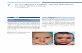 7 Lip Pits; Orthodontic Treatment,Dentition and … Inheritance In most cases of lip pits described during the last 120years, a marked hereditary pattern was observed. Although all