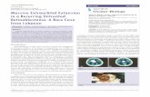 Massive Extraorbital Extension in a Recurring Untreated ... Extraorbital Extension in a Recurring Untreated Retinoblastoma: A Rare ... Retinoblastoma: A Rare Case ... GJ, Sanders BM