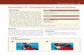 Procedure 17: Cardiopulmonary Resuscitation - … · Cardiopulmonary Resuscitation 349 ... airway management and ventilation are to children in CPA what ... standard newborn carePublished