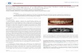 lu et al, Dentistry 21, Dentistry - OMICS International · Dentistry ¬ ¯ È K ± K ½÷lu et al, Dentistry 21, 4:5--3115,11-114 ase Report Open Access 3 4 114 Dentistry ... (Micerium