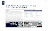 Feature 3D-CT: A better map for hip surgery€¦ · with 3D-CT is a more recent concept in orthopaedics. ... A better map for hip surgery ... such as femoral fracture and leg length