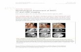 Morphological Assessment of RVOT: CT and CMR Imagingimaging.onlinejacc.org/content/jimg/6/5/631.full.pdf · Morphological Assessment of RVOT: CT and CMR ... Cardiac computed tomography