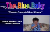 “Cyanotic Congenital Heart Disease” - Chandler, Arizona · Pediatric Cardiologist “Cyanotic Congenital Heart Disease ... –Modified B-T shunt (a synthetic tube