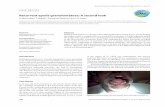 Recurrent epulis granulomatosa: A second look - JCRI REPORT.pdfRecurrent epulis granulomatosa: A second look ... extraction socket, ... of the complications of a traumatic extraction