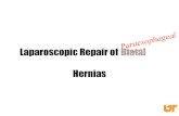 Laparoscopic Repair of Hiatal Hernias · Conclusions • Laparoscopic repair of paraesophageal hernia can be performed safely and with good results • Operative experience and attention