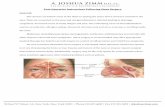 Post-Operative Instructions Following Sinus … Instructions Following Sinus Surgery ... orm al f u nc ti. ... especially if you have nasal polyps.