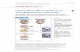Lipoprotein(a) Induces Human Aortic Valve Interstitial ...basictranslational.onlinejacc.org/content/btr/2/4/358.full.pdf · Lipoprotein(a) Induces Human Aortic ... ortic valve stenosis