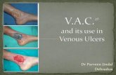 Dr Parveen Jindal Dehradun - VAI | venuous association …venous.in/presentationtalk/Dr Parveen Jindal (VAC).pdfDr Parveen Jindal Dehradun Venous Leg Ulcers affect around 1% of the