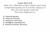 Case 31A & B - Virtual Pathology at the University of Leeds€¦ ·  · 2014-09-02Case 31A & B Male 30. Infiltrated scalp nodules and neck ... Kimuras disease ... Head and Face Medicine