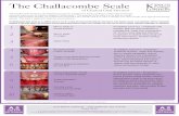 The Challacombe Scale · The Challacombe Scale The Challacombe Scale was developed from research conducted at King’s College London Dental Institute under the supervision of ...