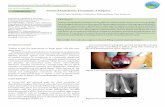 CASE REPORT Unusual Endodontic Treatment: A Surprise REPORT.pdf · endodontic treatment of teeth with apical periodontitis. ... Siqueira JF Jr. Aetiology of root canal treatment failure: