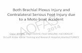 Both Brachial Plexus Injury and Contralateral Serious Foot ... · Both Brachial Plexus Injury and Contralateral Serious Foot Injury due to a Moto boat accident Ozgur BAYSAL, Engin