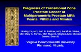 Diagnosis of Transitional Zone Prostate Cancer at ...c.ymcdn.com/sites/ · Diagnosis of Transitional Zone Prostate Cancer at Multiparametric Prostate MRI: Pearls, Pitfalls and Mimics