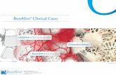 BonAlive® Clinical Cases - CMO Ortopedia Posterolateral fusion (50/50 with autograft) and application of BonAlive® around the anterior cage Outcome: The patient has …