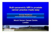 Multi -parametric MRI in prostate cancer practice … internal structure and un -sharp margins 5 –clinically significant disease is ... – False positives : scars, BPH, prostatitis,