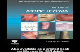 An Atlas of ATOPIC ECZEMA - Zanjan University of Medical file.zums.ac.ir/ebook/007-An Atlas of Atopic Eczema (Encyclopedia... · PDF fileThe 3clinical criteria postulated by Hanifin