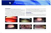 Esófago – Aspecto normal - Editorial Amolca Colombia la laringe, cerca de 15 a 18 cm de la arcada dentaria superior (ADS). El músculo cricofaríngeo se encuentra cerrado en reposo