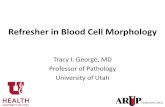 Refresher in Blood Cell Morphology - islh.org · Polycythemia vera . Myeloproliferative/Myelodysplastic syndromes • Atypical chronic myeloid leukemia – Shows significant dysplasia