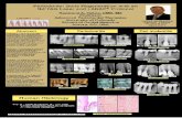  · Periodontal Bone Regeneration with an Nd:YAG Laser and LANAP@ Protocol Osteology Meeting Cannes, France poster # 331 April 2011 Peri-implantitis