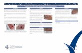 Avoiding amputation using the multi-disciplinary foot … · Avoiding amputation using the multi-disciplinary foot team and appropriate wound care... a case study utilising Eclypse