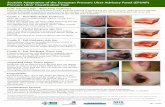 Scottish Adaptation of the European Pressure Ulcer ... Grading Tool.pdf · NATVNS Scottish Adaptation of the European Pressure Ulcer Advisory Panel (EPUAP) Pressure Ulcer Classification