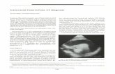 Intracranial Fetus-in-Fetu: CT Diagnosis - AJNR · 1328 YANG Discussion Intracranial fetus-in-fetu is usually not diag nosed preoperatively ( 1, 6). One reason for mis diagnosis is