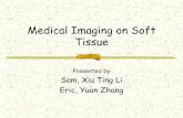 Soft Tissue Medical Imaging - McMaster Universityibruce/courses/EE3BA3_2004/EE3BA3... · Medical Imaging on Soft Tissue Presented by Sam, Xiu Ting Li Eric, Yuan Zhang. About soft
