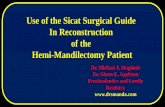 Use of the Sicat Surgical Guide In Reconstruction of …c2-preview.prosites.com/175607/wy/docs/UseofSicatSurgicalGuide.pdf · Use of the Sicat Surgical Guide In Reconstruction of