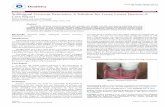 Case Report Sublingual Crescent Extension: A Solution … · Achieving retention and stability in lower complete denture ... The intra oral examination ... Devassy JP (2015) Sublingual