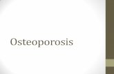 Osteoporosis - Danielle Conlondanielleannadietetics.weebly.com/.../2/7/1/8/27185337/osteoporosis_p… · Outline I. Bone Structure (Jen) I. Types of bone tissue II. Bone modeling/remodeling