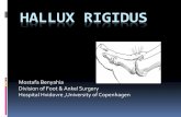 Hallux Rigidus - ortopaedi.dk · Hallux Rigidus Definition • Arthritic condition characterized by stiff painful 1 st MTP joint • Early stages – involvement dorsal aspect