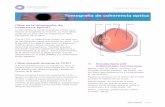 Tomografia de coherencia optica - saeye.com · l Que es la tomografia de coherencia 6ptica? La tomograffa de coherencia 6ptica (TCO) es un ... medir su grosor. Estas medidas ayudan