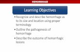 HEMORRHAGE - University of Prince Edward Islandpeople.upei.ca/smartinson/Circ_4-Hemorrhage-17_SAM.pdf · Diapedesis HEMORRHAGE . HEMORRHAGE •Bleeding from a small defect Hemorrhage