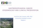 GASTROESOPHAGEAL CANCER EPIDEMIOLOGY AND … · GASTROESOPHAGEAL CANCER EPIDEMIOLOGY AND CLINICAL PRESENTATION Prof Eric Van Cutsem, MD, PhD University Hospitals Leuven Belgium