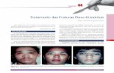 Tratamento das Fraturas Naso-Etmoidais - Dr. Ricardo Lopes ... · ser mais grave do que o impacto lateral pela possibilidade ... Anatomia do ligamento cantal e das vias lacri- ...
