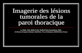 Lésions de la paroi thoracique - pe.sfrnet.orgpe.sfrnet.org/Data/ModuleConsultationPoster/pdf/2013/1/81816212... · Introduction Les lésions tumorales pariétales thoraciques sont