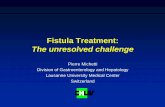 Fistula Treatment: The unresolved challenge History of Fistulizing Crohn's Disease in Olmsted County, Minnesota 54% 24% 9% 13% perianal enteroenteric rectovaginal other • Fistulas