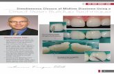 Marcos Vargas, DDS · Marcos Vargas, DDS Simultaneous Closure of Midline Diastema Using a 7 An interproximal carving (IPC) instrument is used to adapt the resin to proper contour