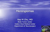 Meningiomas - Cedars-Sinai · Meningiomas Ray M Chu, MD Brain Tumor center Cedars Sinai Medical Center Department of Neurosurgery . Overview ... –TruBeam, Trilogy, Novalis, Cyberknife