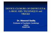 DEVICE CLOSURE OF DIFFICULT & LARGE ASD- TECHNIQUE and … · Patient Selection Key to success! Is the defect suitable for transcatheter closure Criteria: ASD secundum with max diameter